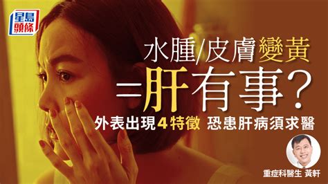 肝不好有哪些症状|出現9大症狀，代表肝病上身？江坤俊醫師一次說清楚